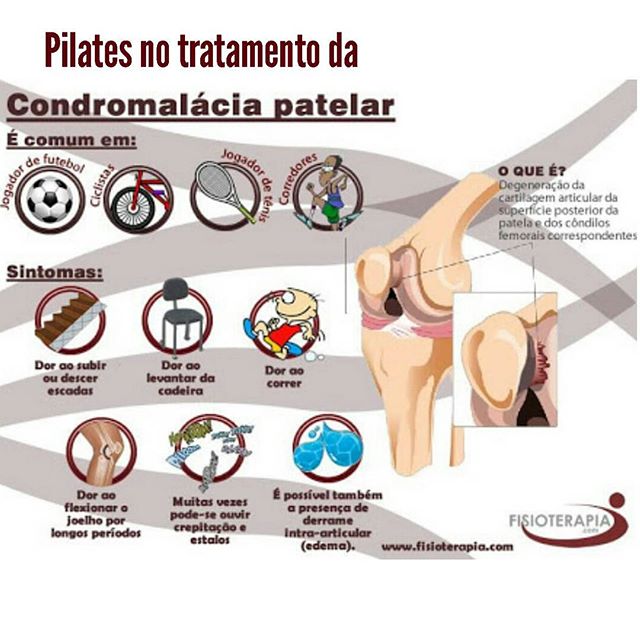 O alongamento e fortalecimento que são bases do método agem de forma eficaz no tratamento.O pilates promove o alinhamento patelar, bem como na estabilização do quadro. Um dos grandes alicerces do método é o fortalecimento e estabilização dos músculos centrais do corpo.  No caso da condromalácia patelar são inclusos exercícios de potência, força, alongamento e mobilização do membro inferior, sempre com o cuidado de evitar sobrecarga na articulação em questão, é importante o alongamento dos ísquiotibiais, uma atenção especial ao quadríceps, sobretudo o vasto medial e banda iliotibial, tendões e panturrilha também são extremamente necessárias para equilibrar as forças atuantes sobre a patela.Pilates é saúde .. Venha fazer um método que condiciona seu corpo e melhora sua saúde. Aula experimental grátis 3081-9113.#pilates #saúde #bemestar #floxpilates #floxsaúde #pilatesesaude #pilates no joelho